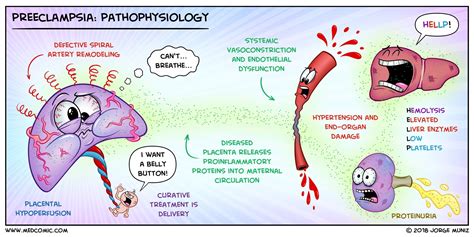 Preeclampsia Pathophysiology Medcomic