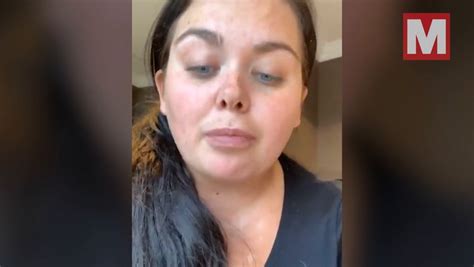 Scarlett Moffatt In Cancer Scare After Abnormal Smear Test Results