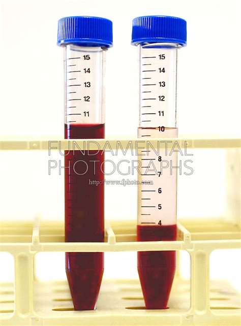 Centrifuge Blood Sample Plasma Separation Fundamental Photographs