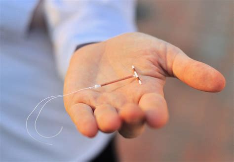 Should You Try To Remove Your Own Iud Cleveland Clinic
