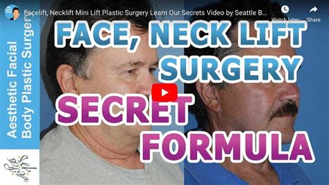 Different Types Of Facelifts S Lift Mini Face Lift Seattle Bellevue