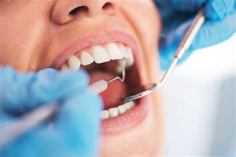 What Is A Dental Check Up Procedure Markham Smile Centre