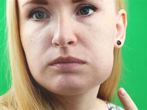 Swollen Cheek Treatment गाल पर सूजन के क्या कारण हो सकते हैं जानें 5