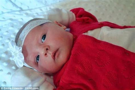 Baby Is Scarred After Her C Section Delivery Daily Mail Online