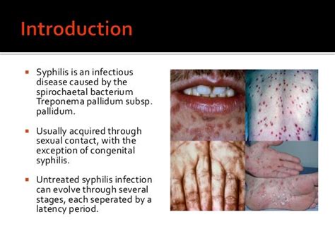 Systemic Manifestation Of Acquired Syphilis