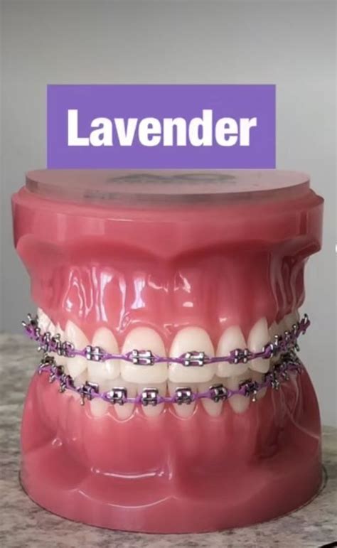pin by anabellu on braces braces colors cute braces dental braces colors