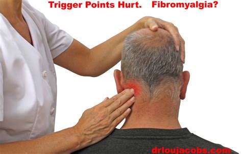 Do You Have Muscle Rocks Trigger Point Therapy Jacobs Chiropractic Acupuncture