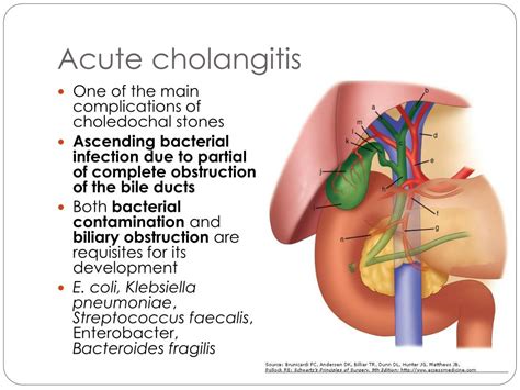 Ppt Abdominal Pain Powerpoint Presentation Free Download Id4271847