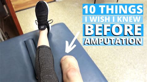 10 Things I Wish I Knew Before Losing My Leg Youtube