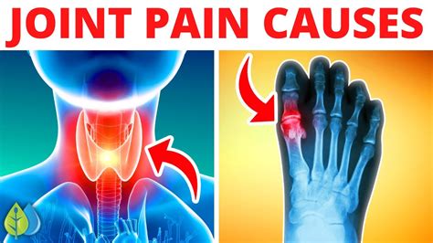 Top 9 Causes Of Joint Pain Youtube