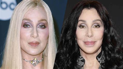 Chers Stunning New Look Plastic Surgeons Weigh In