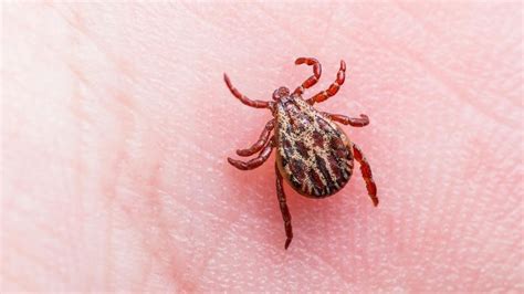 Experts Warn Potentially Fatal Tick Bites On The Rise In Tennessee