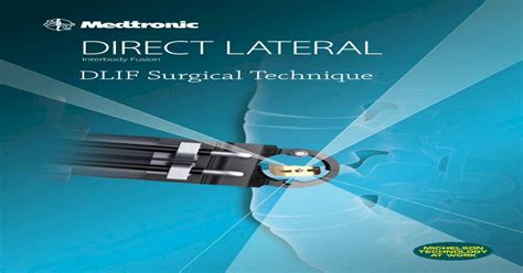 Direct Lateral · Pdf Filedirect Lateral Interbody Fusion Transpsoas