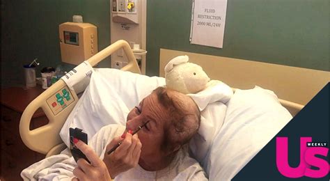 Abby Lee Miller Shows Off Scars Removes Wig During Cancer Pics