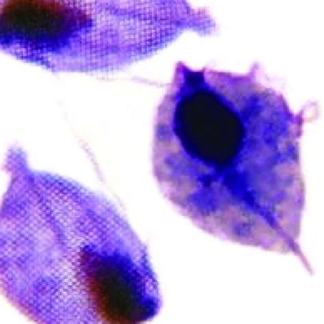 Light Microscopic Picture Of Trichomonas Vaginalis In Smear Download