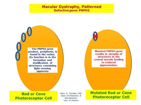 Macular Dystrophy Patterned 1 Hereditary Ocular Diseases