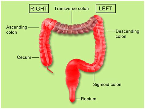 Cancer Of The Colon Versus Rectal Cancer Whats The Difference