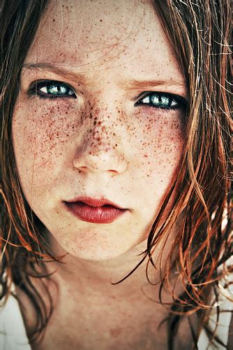 Freckles Chloes World Of Fashion