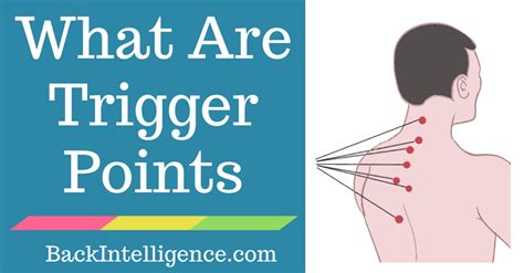 What Are Myofascial Trigger Points And 5 Ways To Release Them 2022