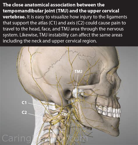 Tmj And Tinnitus Should We Explore The Ligament Chain From The
