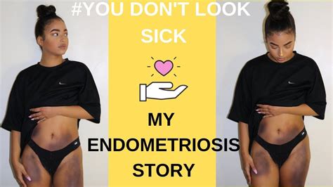 My Endometriosis Story Its Time To Talk About It Youtube