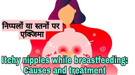 निप्पल या ब्रैस्ट पर खुजली के क्या कारण हो सकते हैं itchy nipples causes and treatment youtube