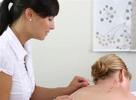 What Are The Benefits Of Acupuncture For Vertigo