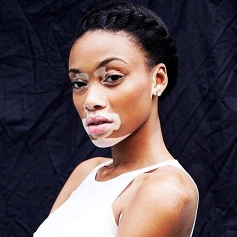 How Antms Winnie Harlow Inspires Us To Remain Positive