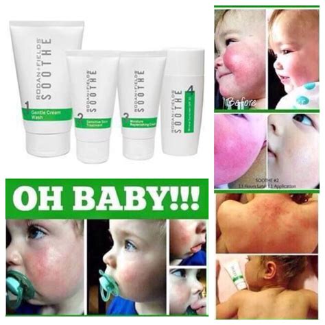 Best Formula To Give Baby With Eczema Eczema Baby Itchy Baby Eczema