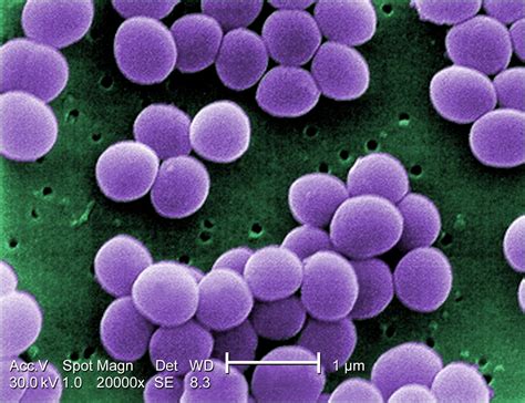Filestaphylococcus Aureus Visa 2 Wikipedia