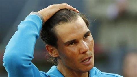 Rafael Nadal Spends €9000 On Hair Transplant In Madrid