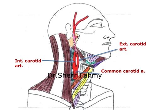 In anatomy, the left and right common carotid arteries (carotids) (english: Carotid Arteries (Anatomy of the Neck)