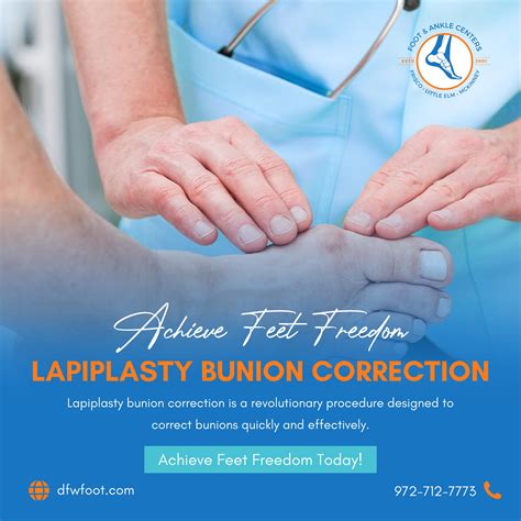 Achieve Feet Freedom With Lapiplasty Bunion Correction Foot And Ankle