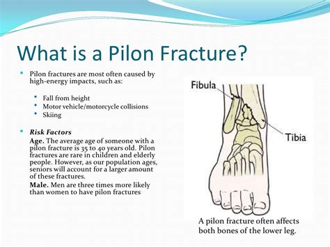 Pilon Fractures