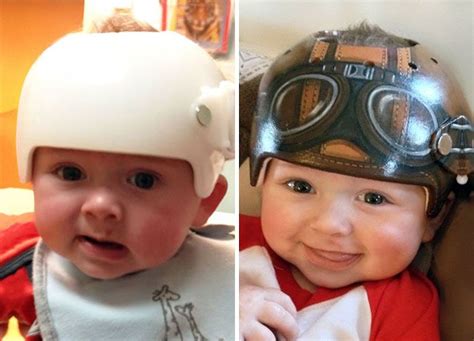 Baby Helmet Head Protection Kiana Canty