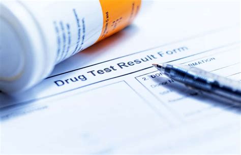 Random Drug Testing A Complete Guide For Employers Iprospectcheck