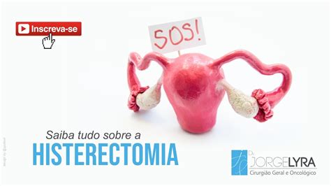 Histerectomia Saiba Mais Sobre Esta Cirurgia YouTube