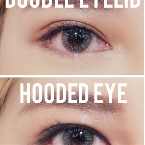 What Is The Difference Between Double Eyelids And Hooded Eyelids