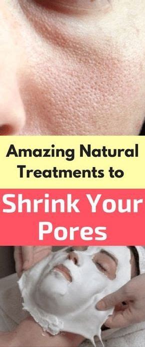 They help tighten the skin and are perfect if you wish to see results in an instant. 10 Best Natural Treatments to Shrink Large Pores | Shrink ...