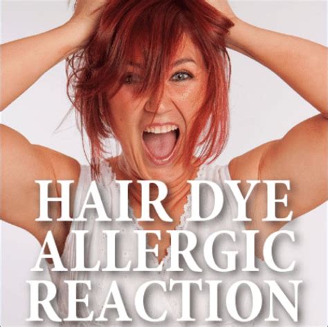 Hair Dye Allergies Help Hair Dye Allergy Dyed Hair How To Dye