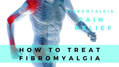 Fibromyalgia Pain Relief How To Treat Fibromyalgia Youtube