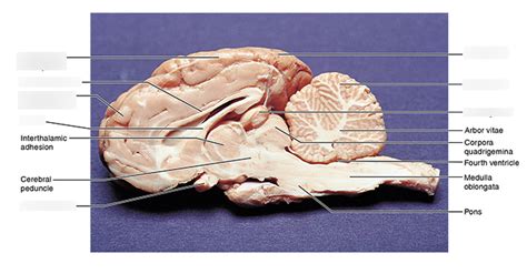 Sheep Brain Dissection 2 Part 1 Diagram Quizlet