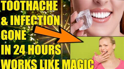 HOME REMEDIES FOR TOOTH INFECTION: SEVERE TOOTHACHE REMEDY - HOW TO