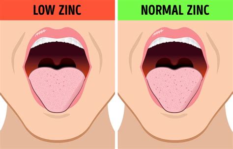 Check spelling or type a new query. Pregnancy Taste In Mouth - Metallic Taste In Mouth In ...