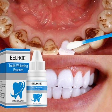 Teeth Whitening Essence Remove Plaque Stains Serum Fresh Breath Oral