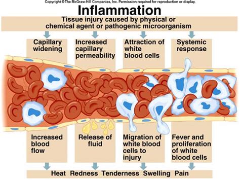 Chronic Inflammation Process Of Chronic Inflammation