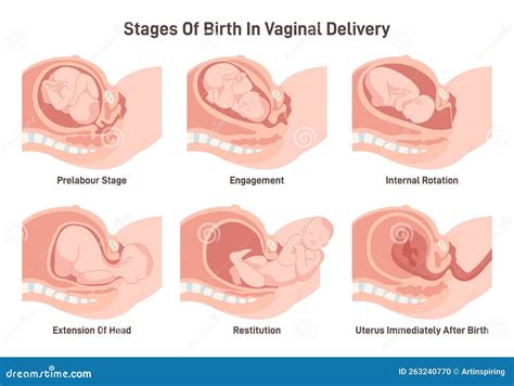 Stadi Di Nascita Nel Parto Vaginale Movimento Del Feto Durante Il Parto Illustrazione