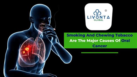 Smoking And Chewing Tobacco Are The Major Causes Of Oral Cancer Livonta Global Pvt Ltd
