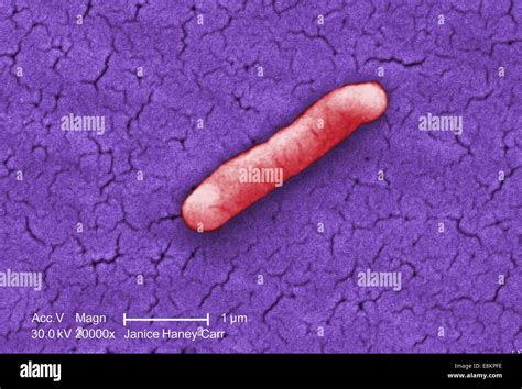 Salmonella Typhi Hi Res Stock Photography And Images Alamy