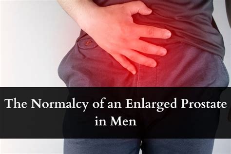 The Normalcy Of An Enlarged Prostate In Men Urology South Bend